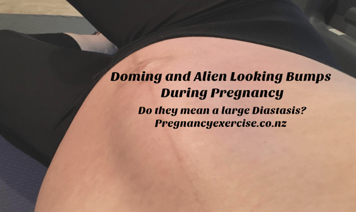 Does Doming Of The Stomach Muscles Mean A Diastasis